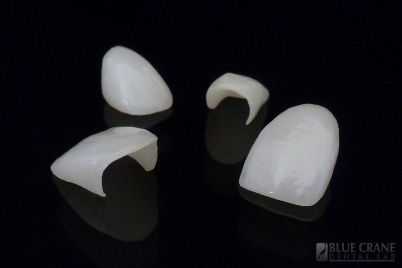 IPS e.max Blue Crane Dental Lab